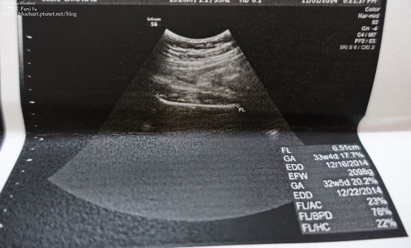 『孕。二寶』每次產檢都會收到震撼彈-34W+4D的第八次產檢